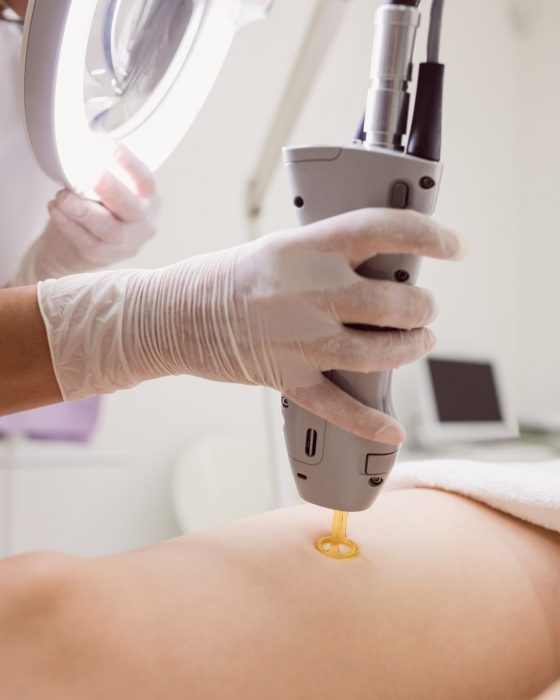 Close up of doctor performing laser hair removal on female patient skin in clinic